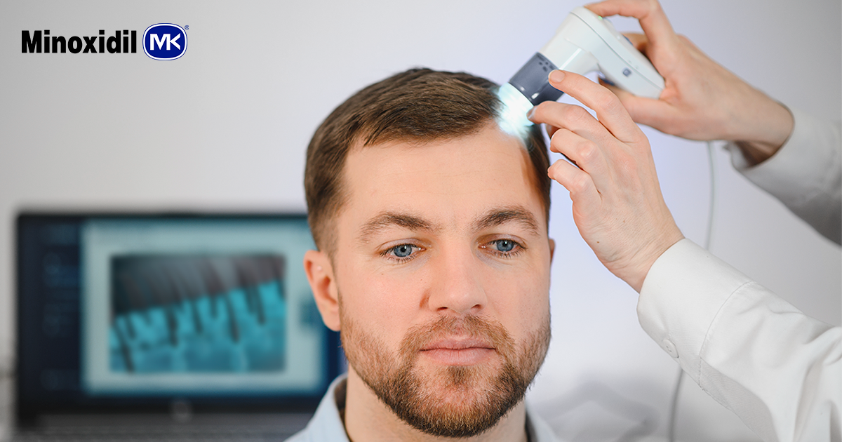 Qué es la alopecia: guía completa para entenderla.