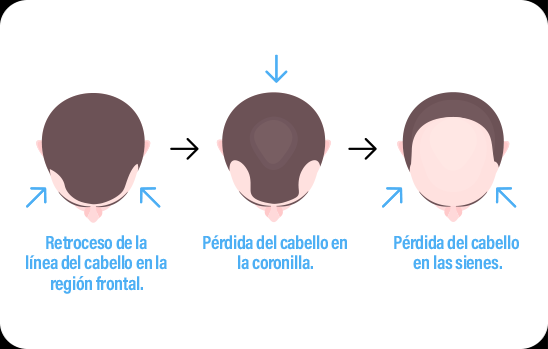 graficaHombre