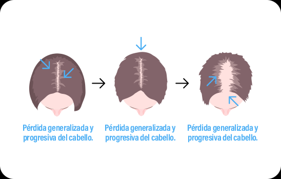 graficaMujer